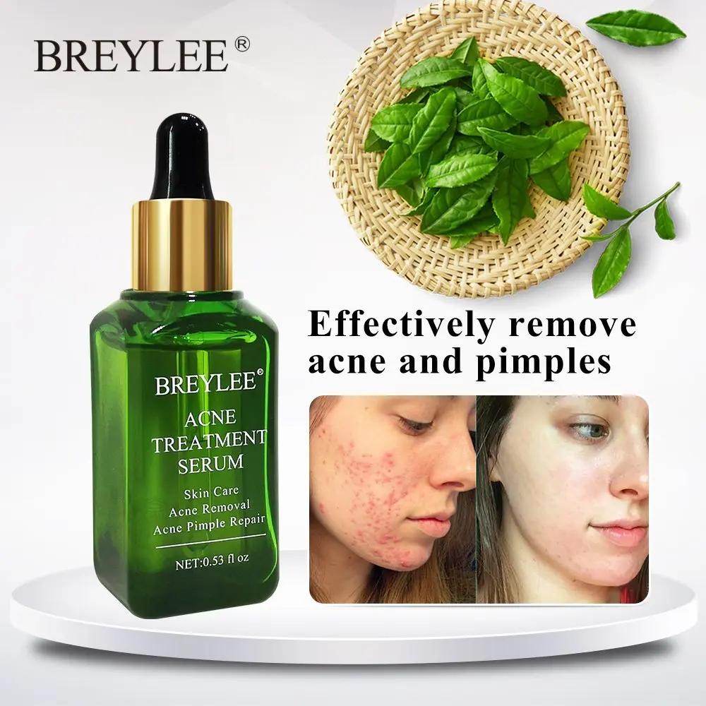 BREYLEE  Acne Repair Serum – Sérum Anti-Acné & Réparateur aux Extraits de Plantes Naturelles PINK COCO